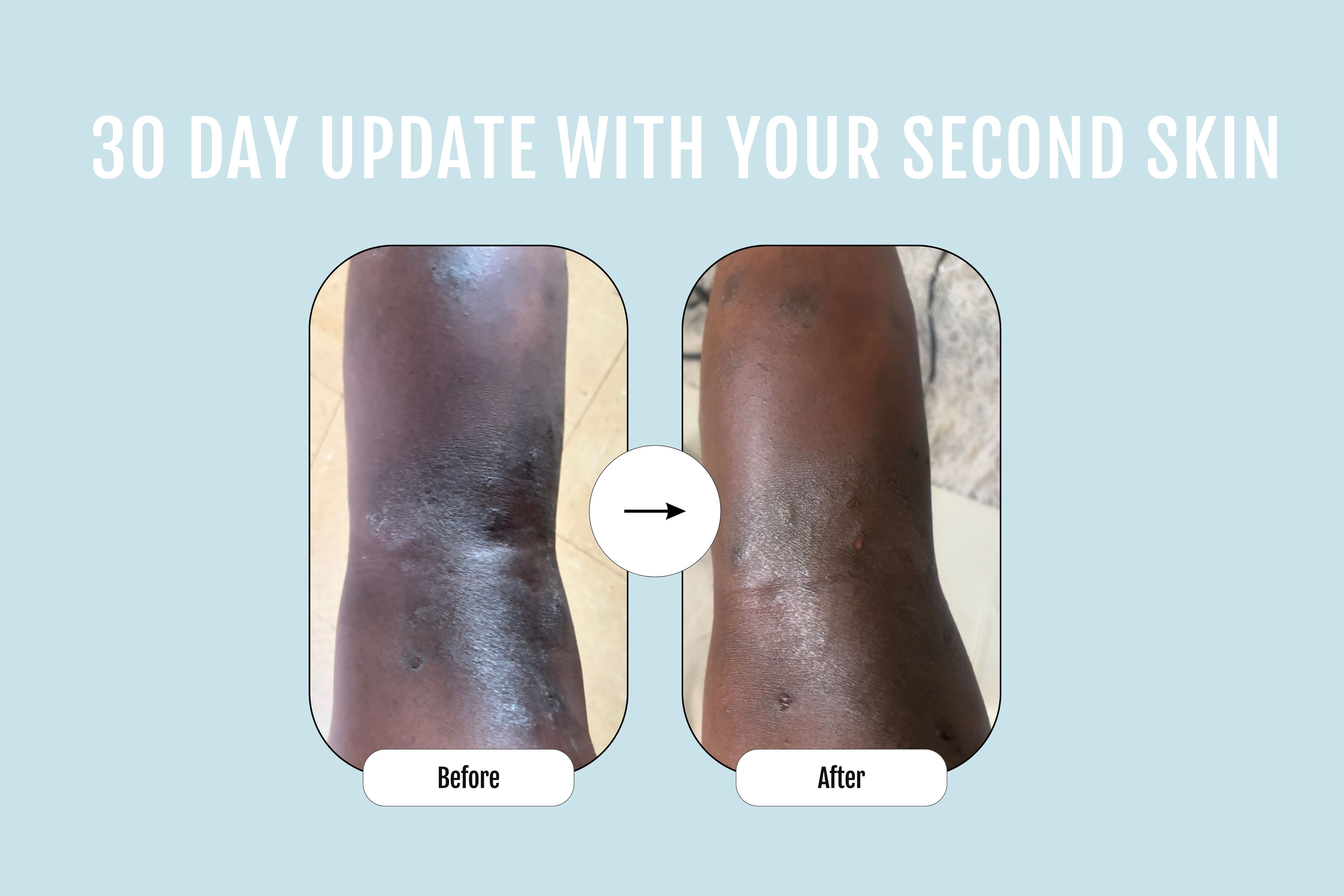 SECOND SKIN RESCUE BALM