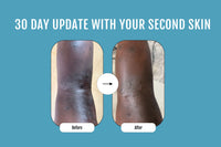 SECOND SKIN RESCUE BALM